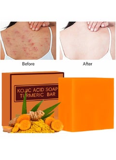 EELHOE Kojic Acid Soap Turmeric Bar- Anti-acne Dark Spot Corrector Soap,Brightning Deep Cleansing Face and Body Turmeric Soap, Tretinoin Soap, Acne Facial Turmeric Kojic Acid Soap Bar  - Image 1