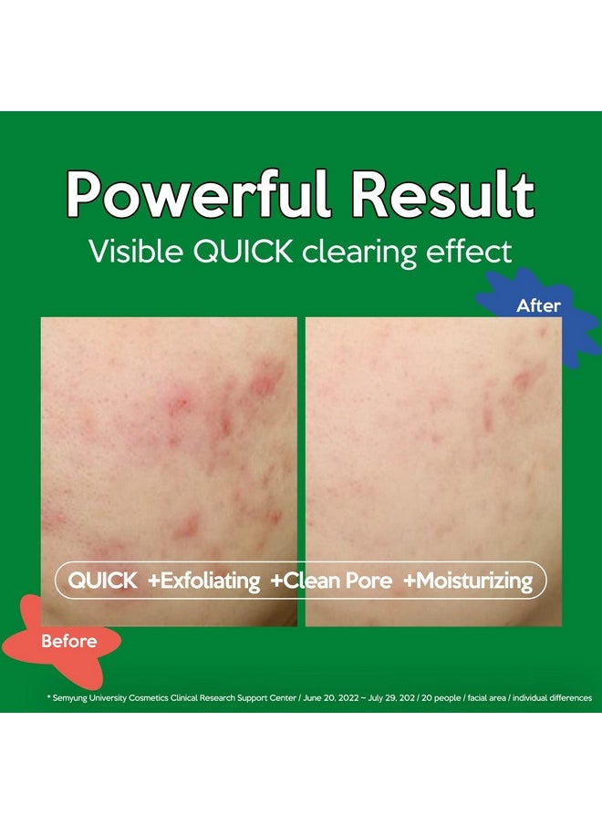 Troubless Troubless Clear Toner Pad for Face | Gentle Peeling & Facial Soothing Toner with Tea Tree, 60 pads (5.57 oz)  - Image 5