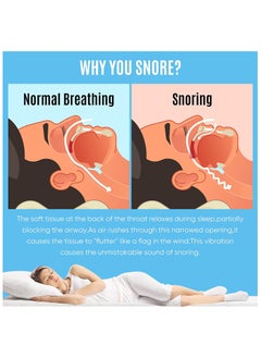 NNEWVANTE Anti-snoring Mask,anti-snoring device to help stop snoring,snoring reduction solution,comfortable and adjustable for men/women.Give people a good night's sleep  - Image 3