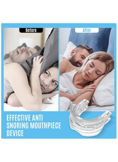 Anti-snoring Mask,anti-snoring device to help stop snoring,snoring reduction solution,comfortable and adjustable for men/women.Give people a good night's sleep - pzsku/Z7777431AD2050DF9B774Z/45/_/1740391099/88b61e5f-62f3-4e05-a022-ddcd51a12489