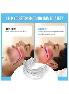 Anti-snoring Mask,anti-snoring device to help stop snoring,snoring reduction solution,comfortable and adjustable for men/women.Give people a good night's sleep - pzsku/Z7777431AD2050DF9B774Z/45/_/1740391138/b4b76290-e6f5-4733-862b-8fcb61a97080