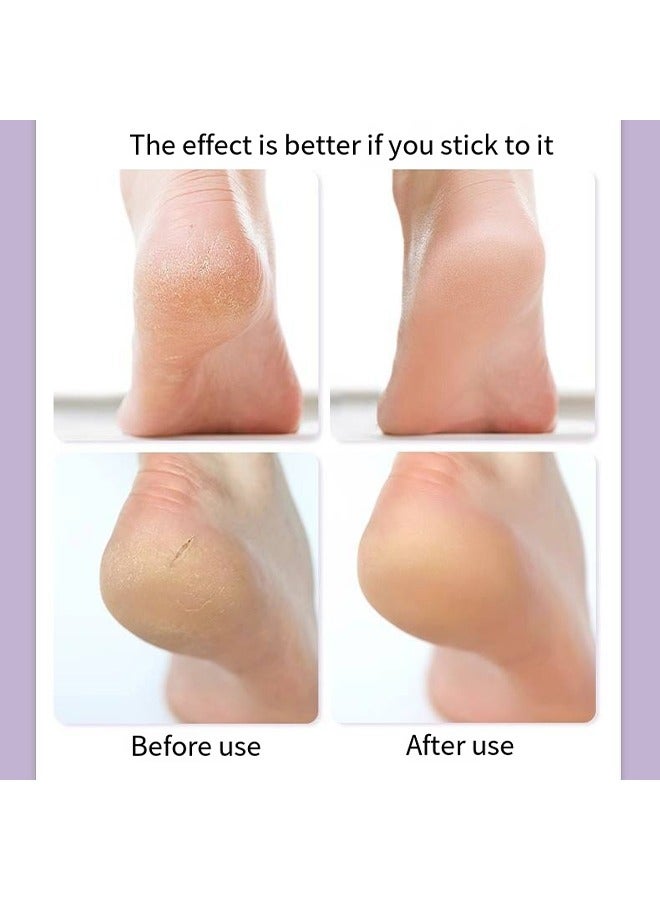 Silicone Socks, Gel Foot Skin Care Moisturizing Socks, Protective Heel Anti-crack Socks, Waterproof Beach Socks, Helps To Remove Calluses Corns Dry Or Cracked Foot Skin (M White) - Image 4