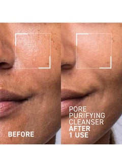 Dr. Brandt Skincare Dr. Brandt Skincare Pores No More Purifying Cleanser - Non-Drying Gel - Cleanses, Purifies, and Dissolves Excess Oil, Residue, and Debris - 3.5 fl oz / 105 ml  - Image 2
