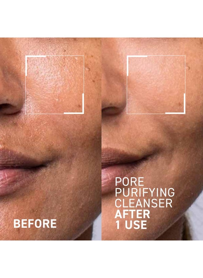 Dr. Brandt Skincare - Dr. Brandt Skincare Pores No More Purifying Cleanser - Non-Drying Gel - Cleanses, Purifies, and Dissolves Excess Oil, Residue, and Debris - 3.5 fl oz / 105 ml - Image 1