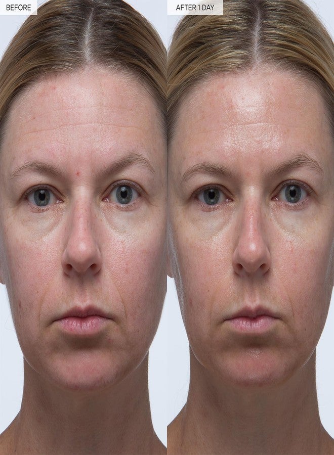 GLOW RECIPE سيروم العناية بالبشرة الكورية من جلو ريسبي - سيروم الوجه المضاد للأكسدة ومكافحة الشيخوخة مع حمض الهيالورونيك - فيتامين ب5 لإصلاح حاجز البشرة الثابت وشد الخطوط والتجاعيد - نباتي، 30 مل - Image 3