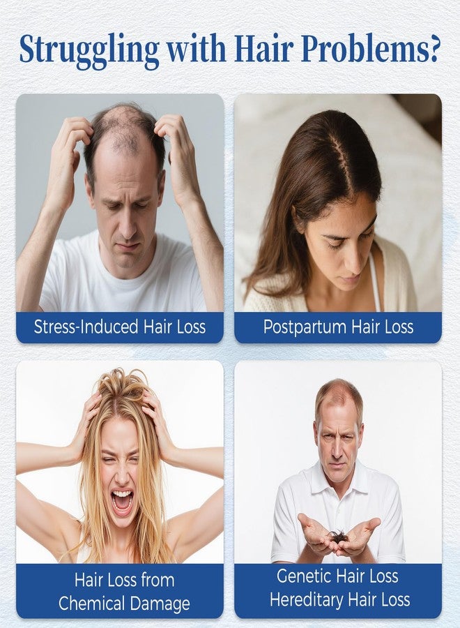 Gluvelessia Hair Growth Serum Roll On with Rosemary，Helps Support Thicker, Fuller Hair Appearance，Clean, Non-Greasy Hair Loss Support for Men & Women，Rosemary，0.84 Fl Oz (Pack of 1) - Image 2