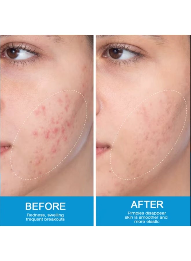 Sumifun Expigment 4% Skin Cream – Effective Solution for Dark Spots & Melasma - Image 3