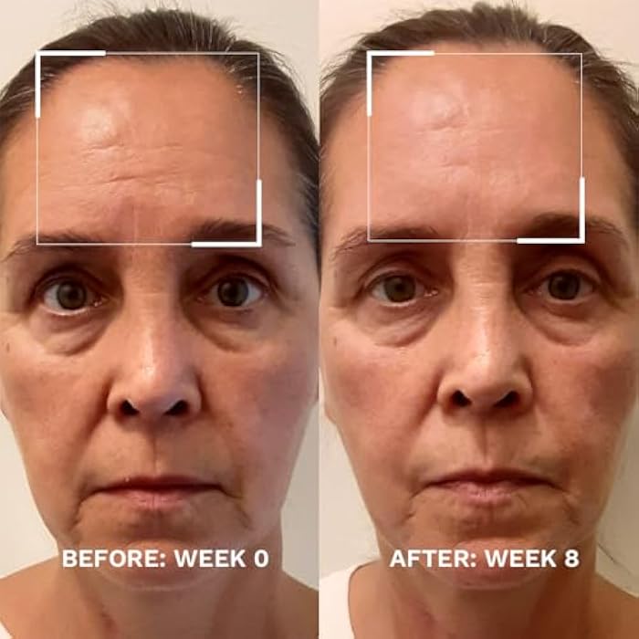 City Beauty Skin-Lifting Booster - Anti-Aging Booster Serum for Face - Lift & Tighten - Sagging Skin Solution with Peptides - Visibly Smooth Fine Lines & Wrinkles - Cruelty-Free, Clean Skin Care - Image 2