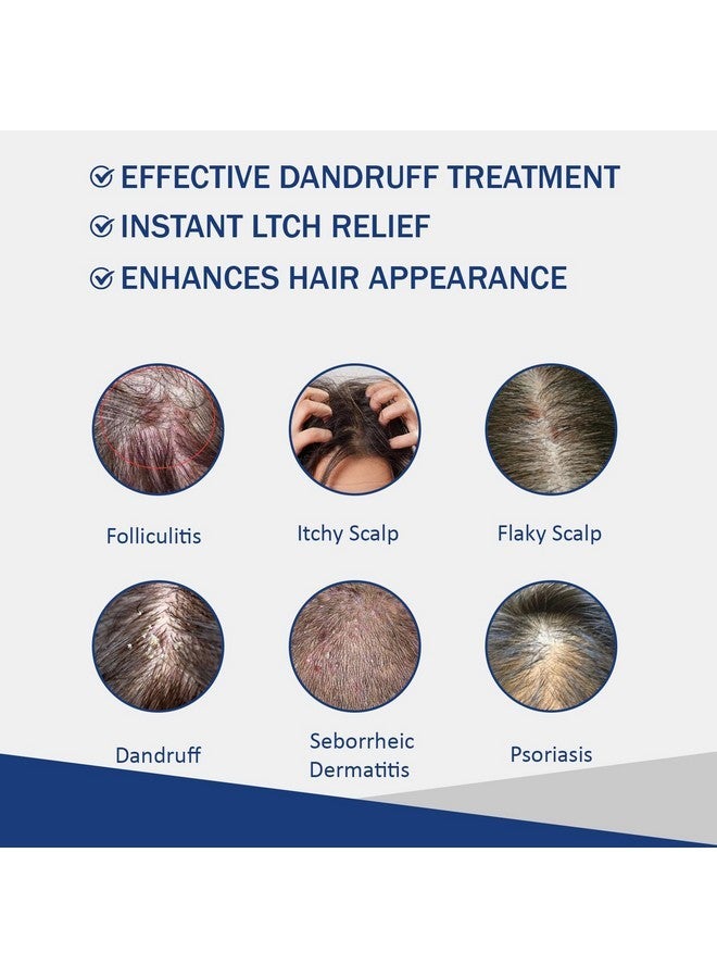 Folliculitis Treatment Shampoo With Formula for Prone to Folliculitis,Seborrheic Dermatitis,For Normal to Oily Scalp Relieves Itchy & Dry Scalp, Dandruff - 10.1 Oz