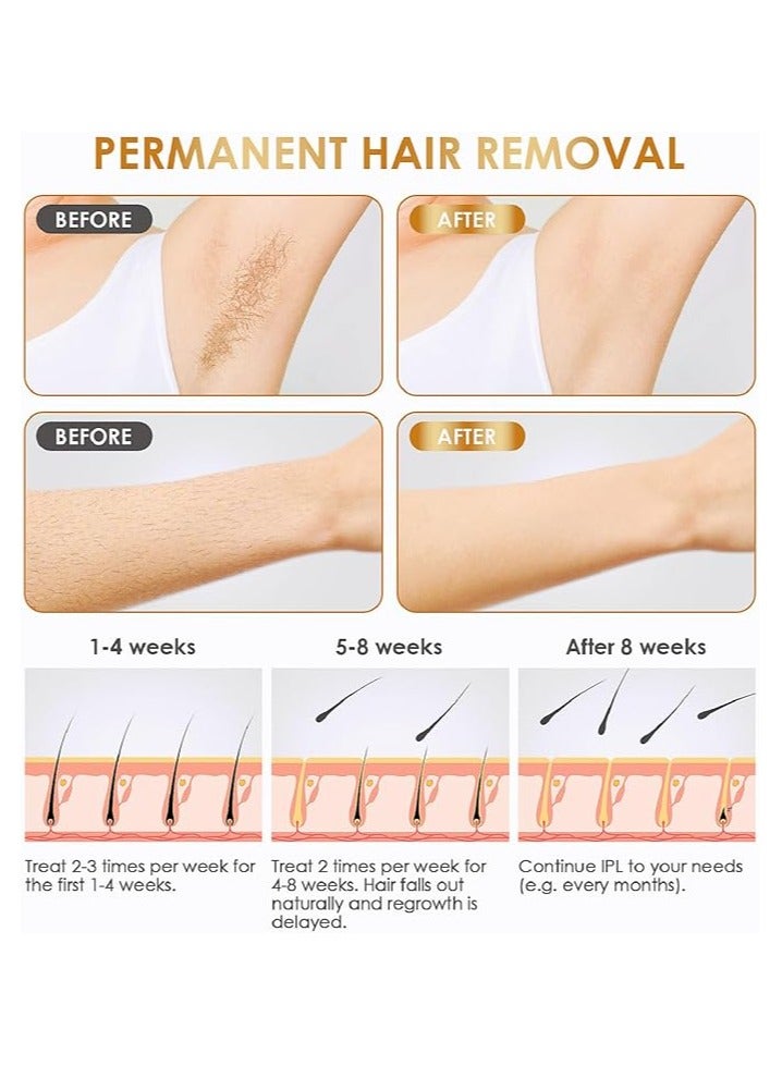 Laser Hair Removal Device, Permanent Painless Hair Remover for Home Full Body Hair Reduction SE4 - Image 2