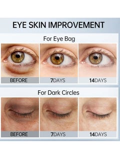AS SEEN ON TV Eye Dark Circles Remover Cream, Hyaluronic Acid Moisturizing Facial Cleanser, Smooth And Gentle Hydrating Foaming Cream Cleanser,  Face Wash Oil For Cleansing Pores, Sensitive Skin Relaxing  - Image 4