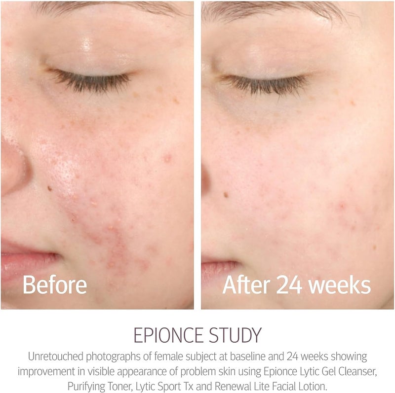 Epionce Purifying Toner for Combination to Oily/Problem Skin - 120ml - Image 3