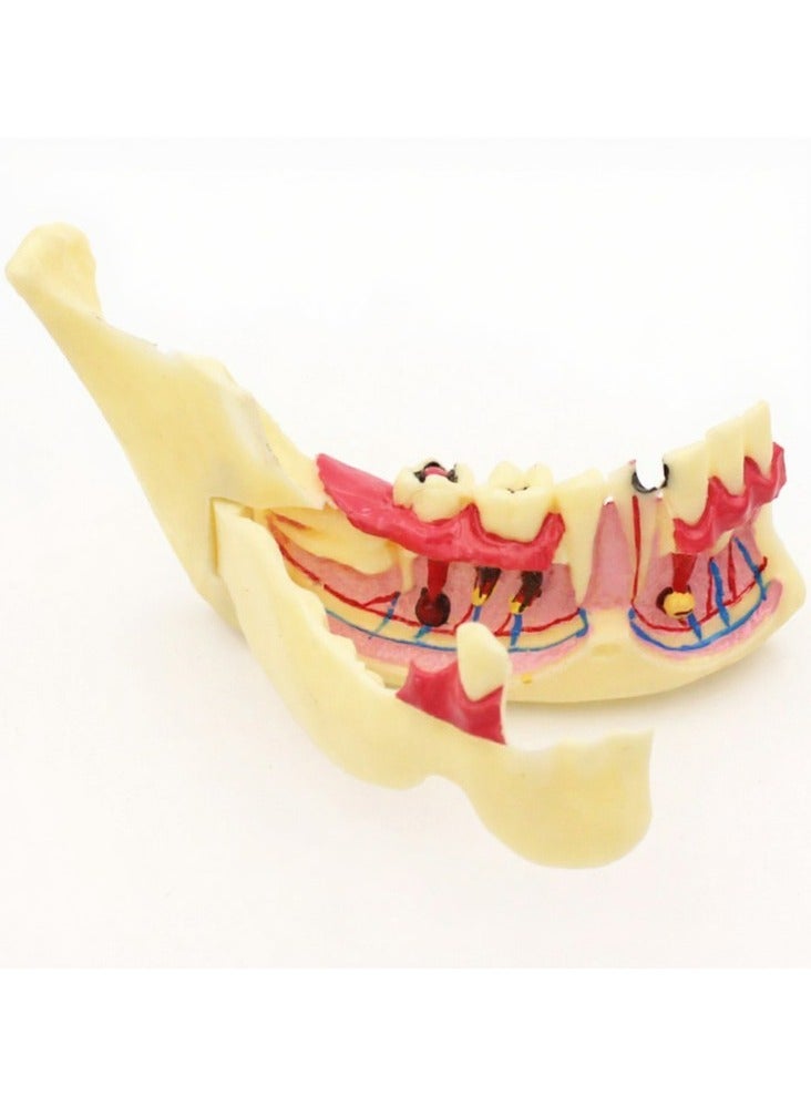 Dental Mandibular Tissue Decomposition Teaching Model
