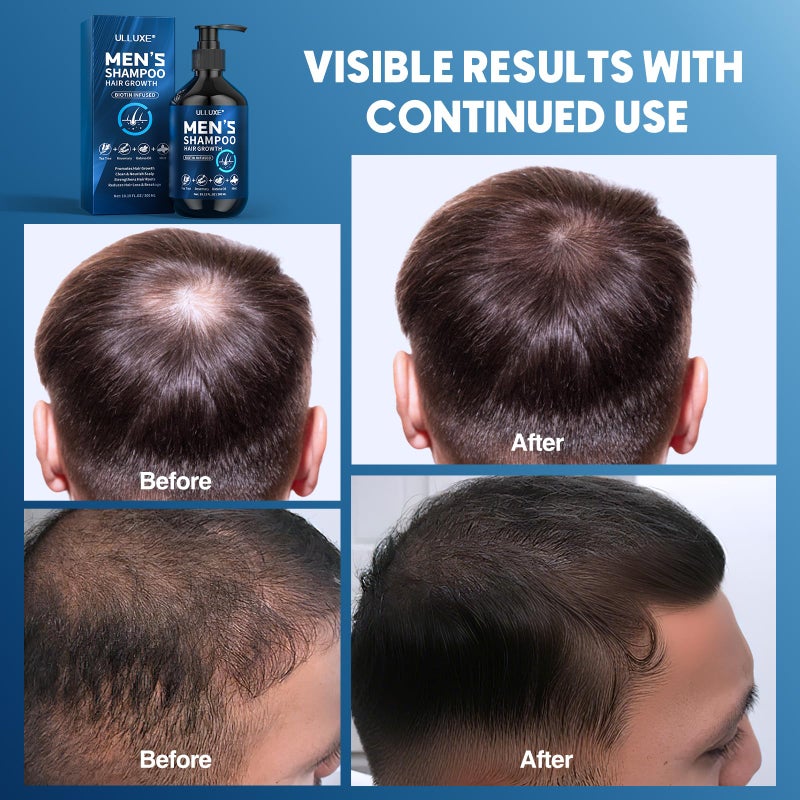 ulluxe Biotin Hair Growth Shampoo for Men: Natural Mens Thickening Shampoo for Hair Loss and Thinning Hair, Infused Rosemary Oil Tea Tree Oil and Mint, Sulfate Free and Color Safe, 10.15 fl.oz - Image 4