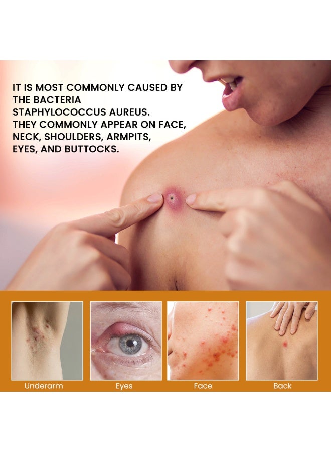 سوميفون كريم سومي فن للعناية الصحية بالأعشاب لعلاج الاحمرار والتورم والجروح، ٢٠ غرام - Image 3