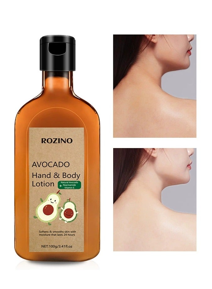 Rozino Avocado body lotion for dry skin in autumn and winter, moisturizing, anti-itching and hydrating avocado body lotion - Image 1
