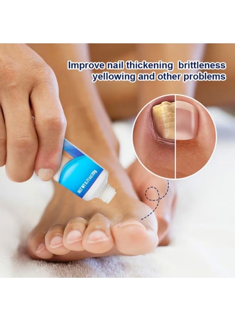 Sumifun Nail Fungus Treatment Cream, Bad Nail Care Ointment, Nail Fungus Treatment, Nail Growth and Repair, Nail Treatment Repair Cream 20g - Image 2