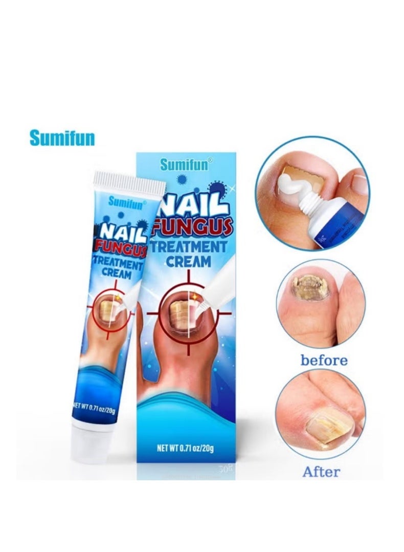 Sumifun Nail Fungus Treatment Cream, Bad Nail Care Ointment, Nail Fungus Treatment, Nail Growth and Repair, Nail Treatment Repair Cream 20g - Image 1