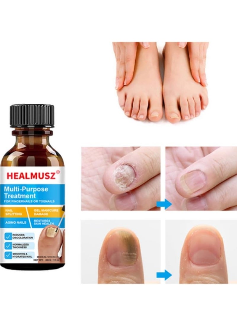 HEALMUSZ - Multi Purpose Nail fungus treatment Fingernails and Toenails Extra Strength Fungus Treatment Toenail Fungus Nail Repair Treatment Solution Restoring Healthy Nails Renewal Foot Gel - Image 1