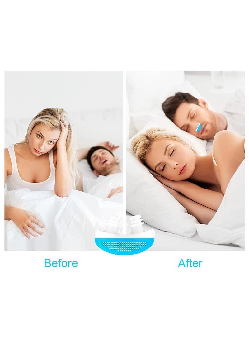 Anti Snoring Nasal Dilator Natural And Comfortable Sleep (Blue) - Image 4