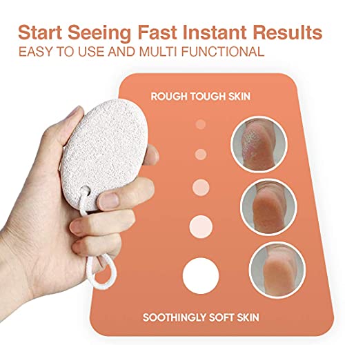 pepplo Natural Pumice Stone for Feet, 1 PCS Lava Pedicure Tools Hard Skin Callus Remover for Feet and Hands - Natural Foot File Exfoliation to Remove Dead Skin, Heels, Elbows, Hands - Image 5
