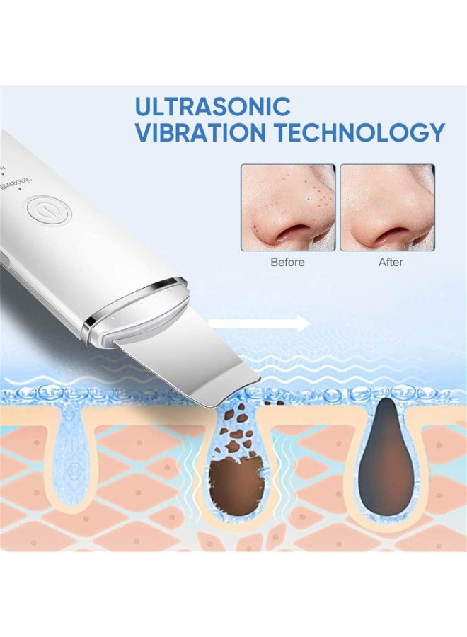 Ultrasonic Skin Scrubber – Portable Facial Blackhead Remover, Peeling & Wrinkle Treatment, USB Rechargeable - Image 5