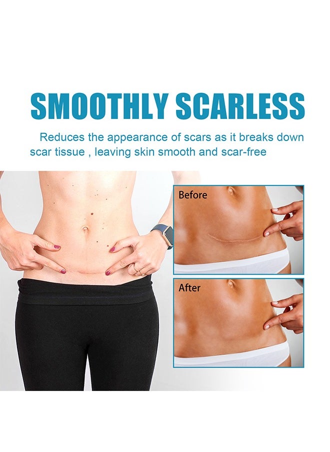 OUHOE - Scar Removing Gel 20g,Scar Removal,Scar Treatment, Scar Removal Cream for C-Section, Stretch Marks, Acne, Surgery, Effective for Both Old and New Scars - Image 1