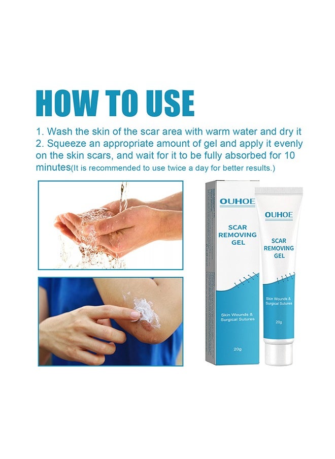 OUHOE - Scar Removing Gel 20g,Scar Removal,Scar Treatment, Scar Removal Cream for C-Section, Stretch Marks, Acne, Surgery, Effective for Both Old and New Scars - Image 1