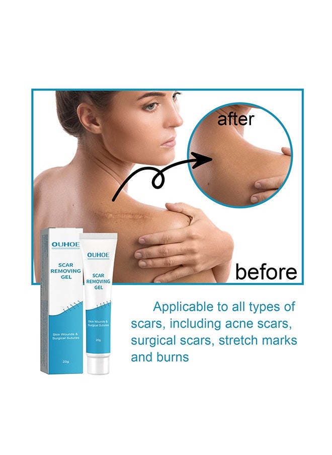 OUHOE - Scar Removing Gel 20g,Scar Removal,Scar Treatment, Scar Removal Cream for C-Section, Stretch Marks, Acne, Surgery, Effective for Both Old and New Scars - Image 1