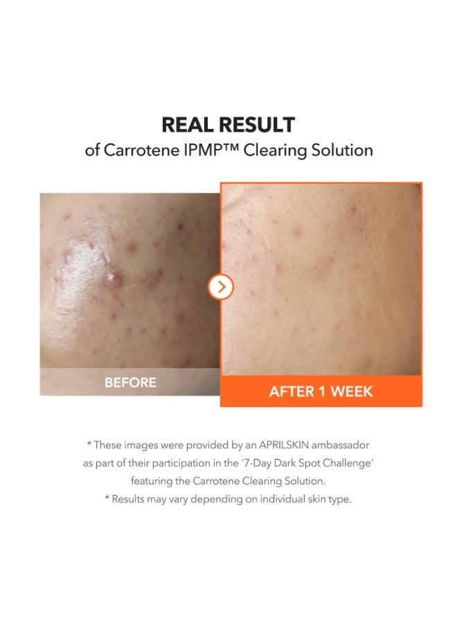 أبريل سكين [APRILSKIN] Carrotene IPMP Clearing Solution 20ml - Image 5