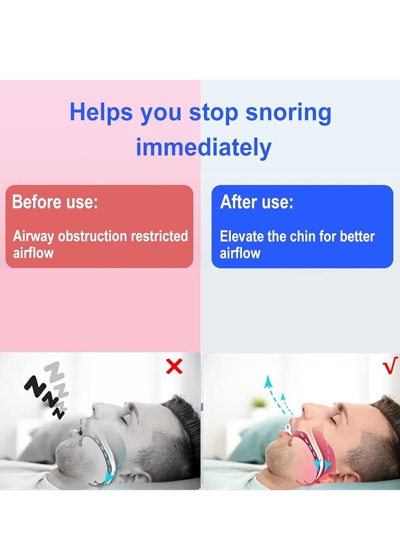 Rightsure Anti-snoring mouthguards, nighttime sleep mouthguards, reusable nighttime sleep mouthguards  - Image 3