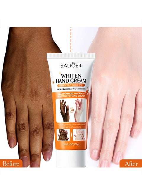 Nicinamide Vitamin C Whitening Hand Cream-Dark Knuckles Fast Brighten Serum, Cracked Soft Moisturizer, Hand Cream, Elbows, Knee, Black Skin, Lighten Stains Remover Product