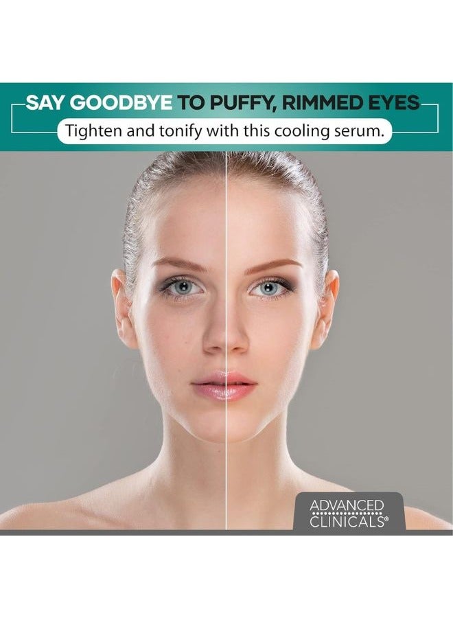 Advanced Clinicals مصل العيون المنتفخة، مصل التصحيح الاحترافي 52 مل - Image 2