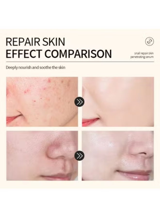 Kormesic سيروم إصلاح الحلزون من كورميسيك 96% 120 مل - Image 2