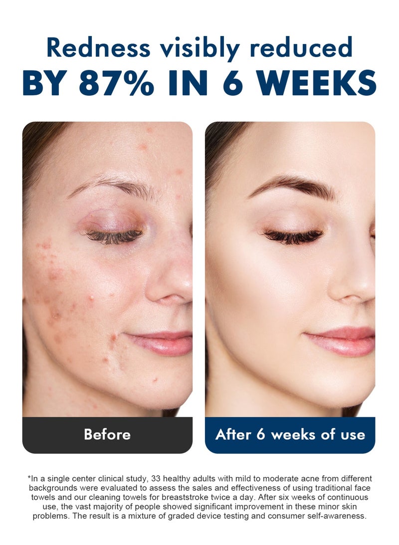 هومار كيت مناشف الوجه نايرا للاستخدام مرة واحدة - مناشف تنظيف الوجه فائقة النعومة، صحية، معتمدة من أطباء الجلدية، للبشرة الحساسة والمعرضة لحب الشباب، قابلة للتحلل الحيوي بنسبة 100%، خالية من الوبر، فائقة الامتصاص - Image 2