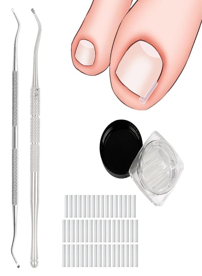 Plexaris Ingrown Toenail Care Tool Set, 50 PCS Nail Strips with 2 Toenail Lifters & 1 Nail Clipper, for Post-Pedicure Care, Post-Sports Foot Care, Daily Toenail Maintenance - Image 1