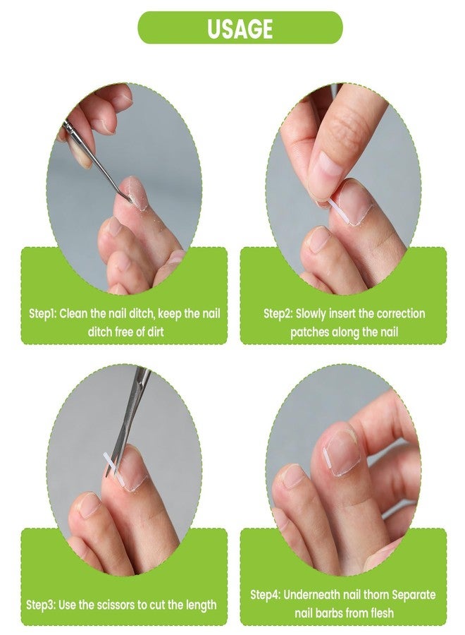 Plexaris Ingrown Toenail Care Tool Set, 50 PCS Nail Strips with 2 Toenail Lifters & 1 Nail Clipper, for Post-Pedicure Care, Post-Sports Foot Care, Daily Toenail Maintenance - Image 3