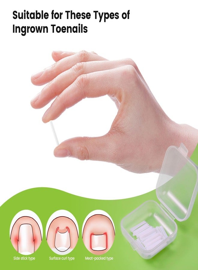 Plexaris Ingrown Toenail Care Tool Set, 50 PCS Nail Strips with 2 Toenail Lifters & 1 Nail Clipper, for Post-Pedicure Care, Post-Sports Foot Care, Daily Toenail Maintenance - Image 4