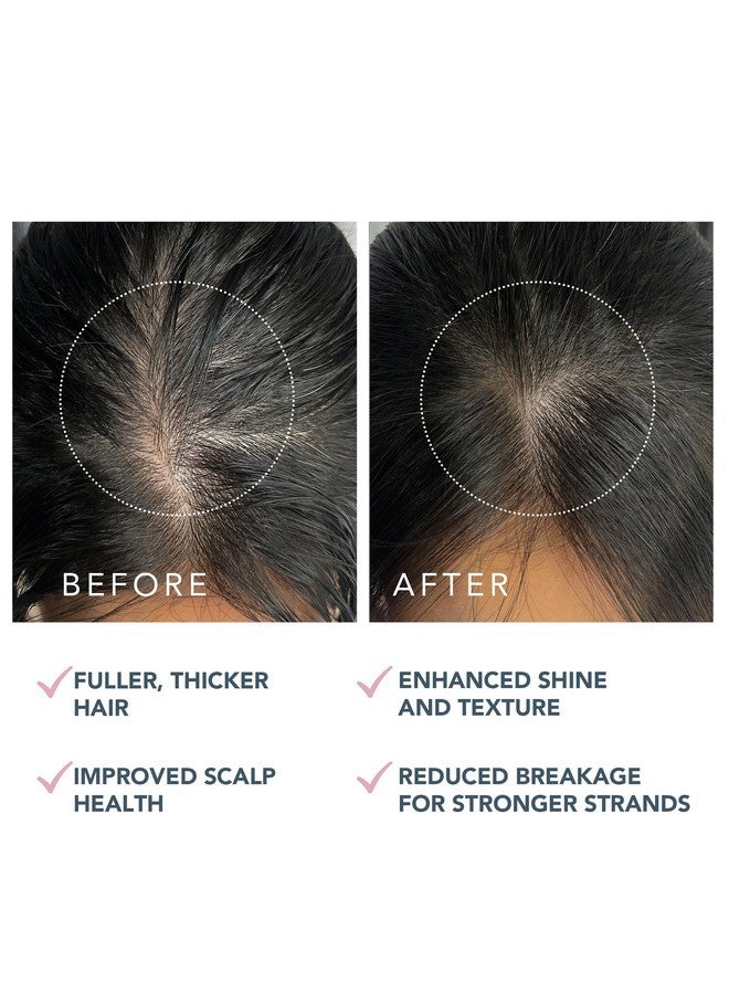 فوريو سيروم فوريو لونا ثنائي الببتيد لفروة الرأس - لنمو الشعر وعلاج فروة الرأس بخلاصة السيكا والرجلة - سيروم للشعر لنمو الشعر وتكثيفه وعلاج تساقطه - 2 أونصة سائلة - Image 5