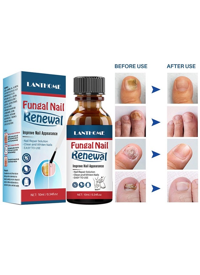 Lanthome Fungal Nail Renewal Improve Nail Appearance, Nail Repair Natural Nail Treatment Extra Strong Nail Solution Fix & Renew Damaged Broken Cracked & Discolored Nails Reduce Nail Thickening Keep Nails Stron  - Image 1