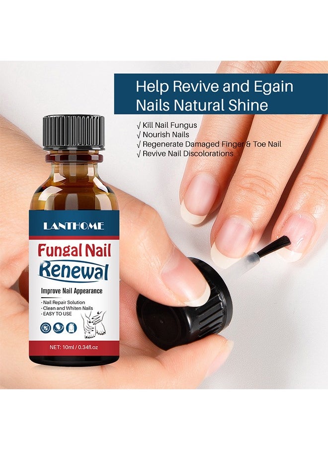 Lanthome Fungal Nail Renewal Improve Nail Appearance, Nail Repair Natural Nail Treatment Extra Strong Nail Solution Fix & Renew Damaged Broken Cracked & Discolored Nails Reduce Nail Thickening Keep Nails Stron  - Image 2