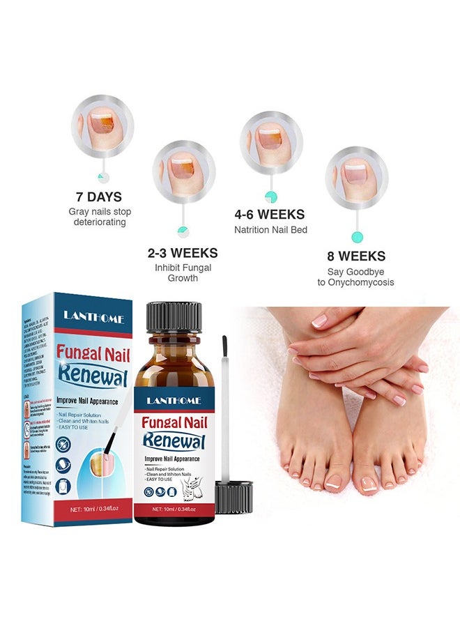 Lanthome Fungal Nail Renewal Improve Nail Appearance, Nail Repair Natural Nail Treatment Extra Strong Nail Solution Fix & Renew Damaged Broken Cracked & Discolored Nails Reduce Nail Thickening Keep Nails Stron  - Image 4