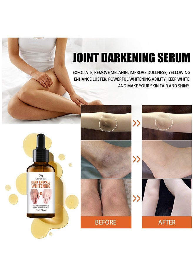 LANEMAY - Dark Knuckle Whitening Serum, Moisturizing, Exfoliates and Reduces Unbalanced Pigmentation, for Removing Dark Elbow and Knee , Brighter, Firmer Skin 30ml - Image 1