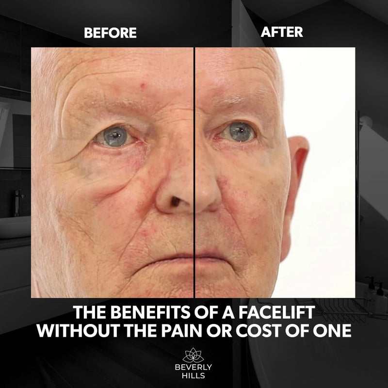 Beverly Hills Mens Instant Facelift and Eye Serum Treatment for Dark Circles, Puffy Eyes, and Wrinkles - Image 3