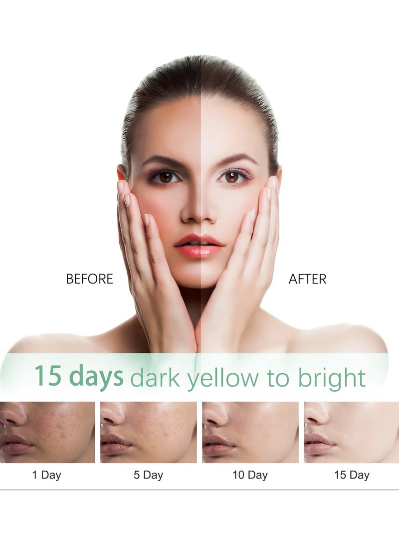 KANGYUAN - Facial Cleanser Whitening Freckle Face Wash Dark Pore Oil Control Thin Cleansing Foam Shrink Spot Soothing - Image 1