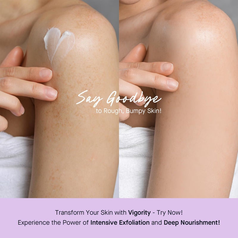 Vigority KP Bump Eraser for Keratosis Pilaris: Body Moisturizer Exfoliating Cream - KP Bump Be Gone Treatment for Bumpy Dry Rough Skin - Image 2