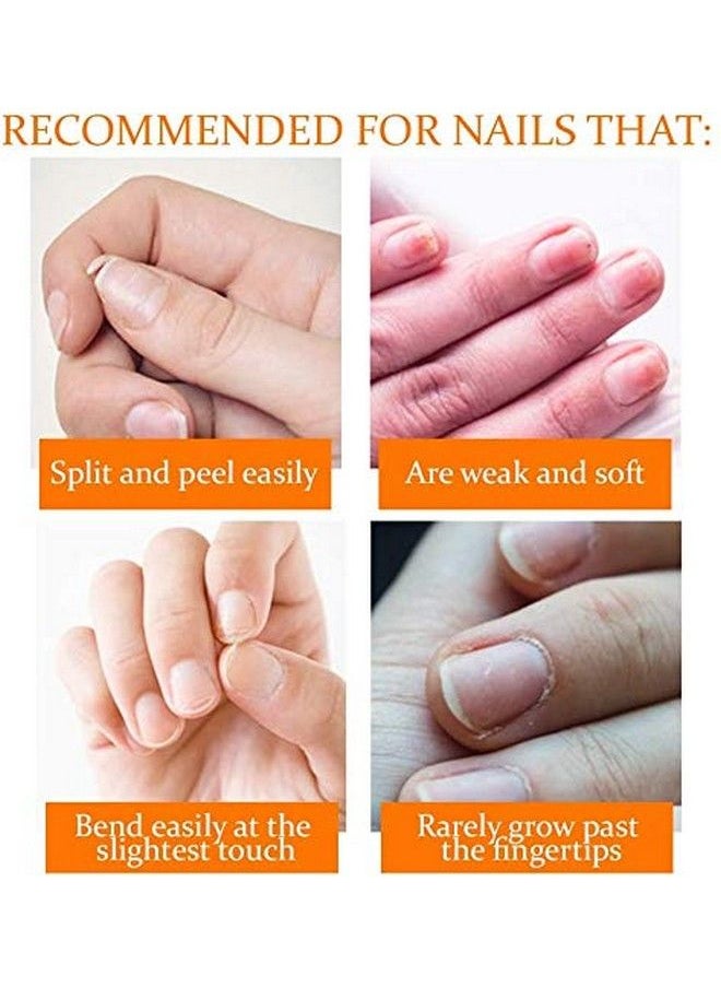 Nail Recovery Kit Cuticle Oil Strengthener Ridge Filler Restore Damaged Nails In 3 Steps - pzsku/Z7803E0AAE1BF5E27F180Z/45/_/1677911744/889bf4a1-8423-48d2-bdb7-da95c29e5034