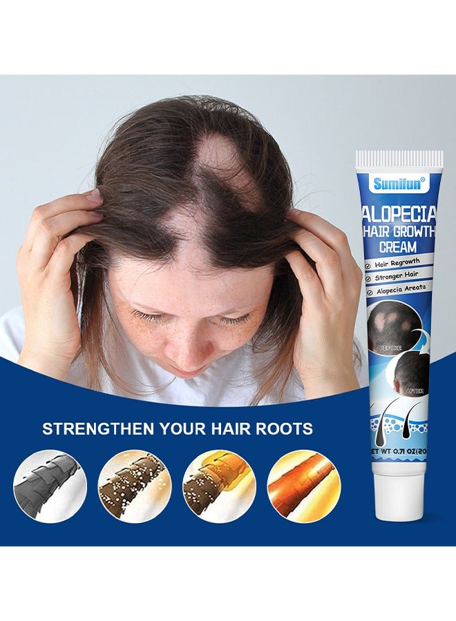 سوميفون كريم نمو الشعر بالثعلبة 20 جرام لتعزيز نمو شعر الرجال ومنع تساقط الشعر والعناية بالشعر - Image 2