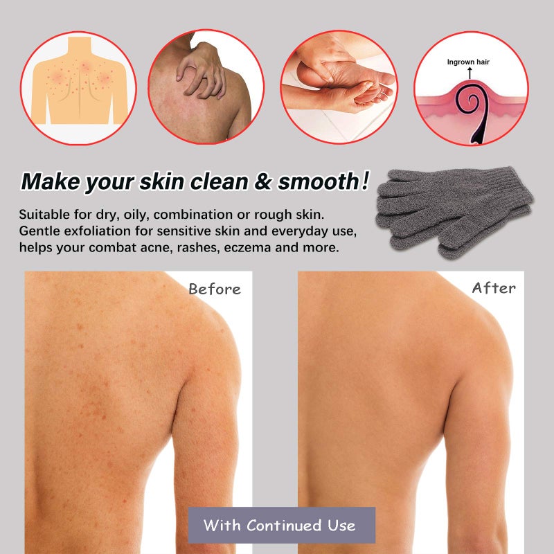 MIG4U Shower Exfoliating Scrub Gloves Medium to Heavy Bathing Gloves Body Wash Dead Skin Removal Deep Cleansing Sponge Loofah for Women and Men 1 Pair Gray - Image 3