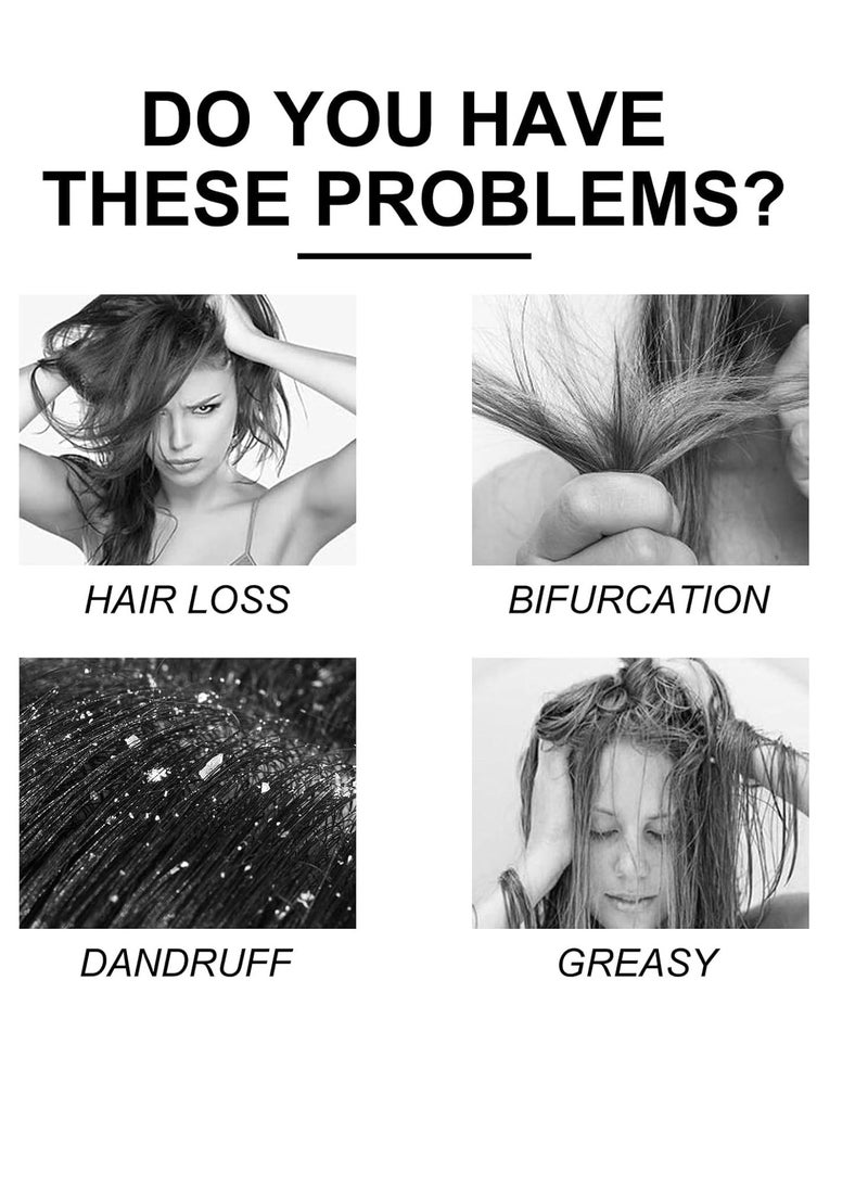 إيست مون شامبو نمو الشعر بالزنجبيل ، شامبو منشط الجذور ، شامبو مضاد لتساقط الشعر بالزنجبيل والسمسم ، شامبو نبات الزنجبيل لتخفيف حكة فروة الرأس الجافة ، يعزز نمو الشعر وينعم 100 مل - Image 2